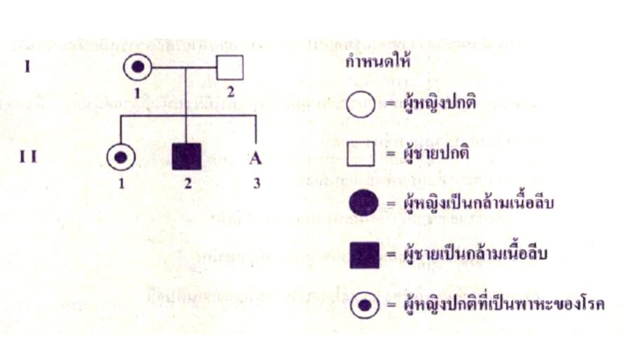 Onet62